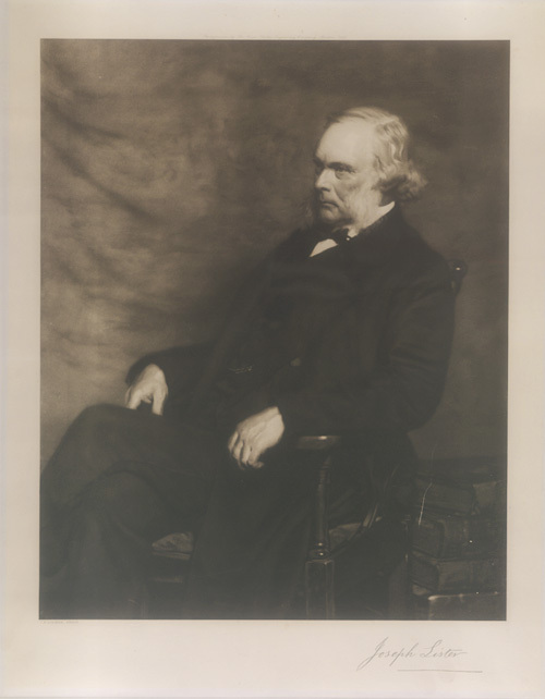Photogravure of portrait of Lister, aged 68, from original painting by John Henry Lorimer (1856-1936). Published by Swan Electric Engraving Company [King’s College London Archives LISTER 2/2]