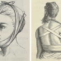 Drawings from the Guide, showing bandaging for a broken jaw (page 15) and a broken collar bone (p16).